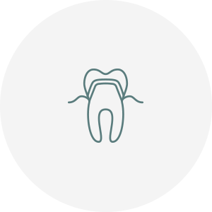 歯周病治療 再生療法